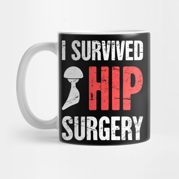 I Survived Hip Surgery | Joint Replacement by MeatMan